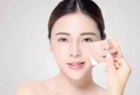 痘博士祛痘加盟品牌扶持有哪些？費(fèi)用多少？