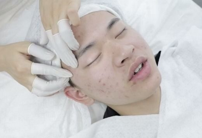 痘博士祛痘加盟 痘博士祛痘加盟