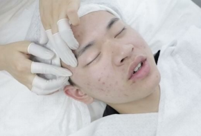 痘博士祛痘加盟品牌優(yōu)勢(shì)是什么？費(fèi)用多少錢？