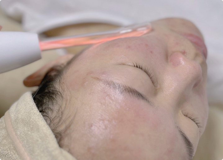 明草堂祛斑祛痘