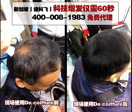 一平米增發(fā)養(yǎng)發(fā)怎么樣？（29天回本）_1