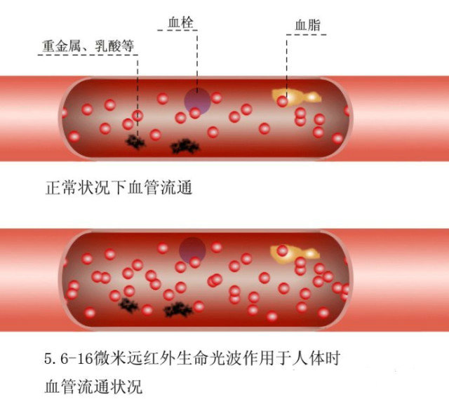 为什么会血管堵塞，喝什么可预防心血管疾病？（图）_2