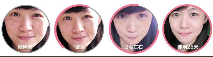 請(qǐng)教秀靚美容院祛斑怎么樣_1