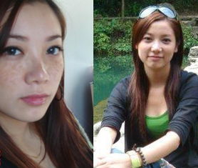 我的秀靚產(chǎn)品祛斑日記_1