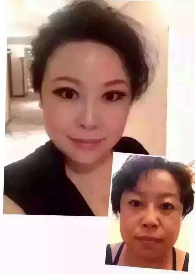 理療加盟、美容加盟、減肥加盟，山佳，火爆賺錢項(xiàng)目_1