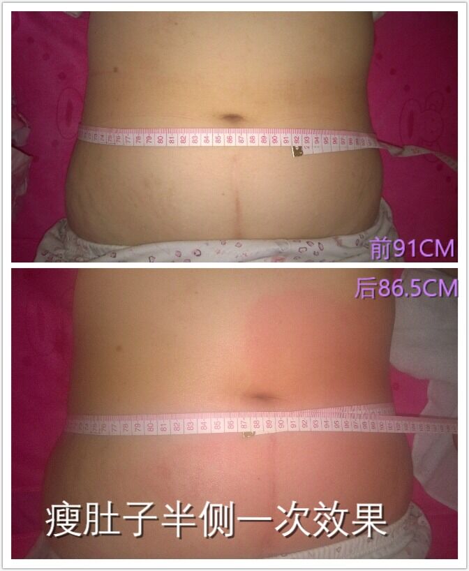 山佳◆賺錢快◆河北美容減肥理療加盟代理招商_1