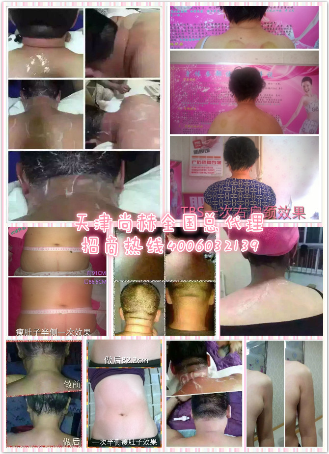 【天津尚赫】全國總代理特色美容減肥理療免費(fèi)加盟【山佳】_1