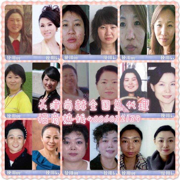 【天津尚赫】減肥加盟指導(dǎo)服務(wù)中心◎山佳◎_1