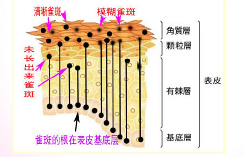 防斑大作战，却是为哪“斑”？（图）_3