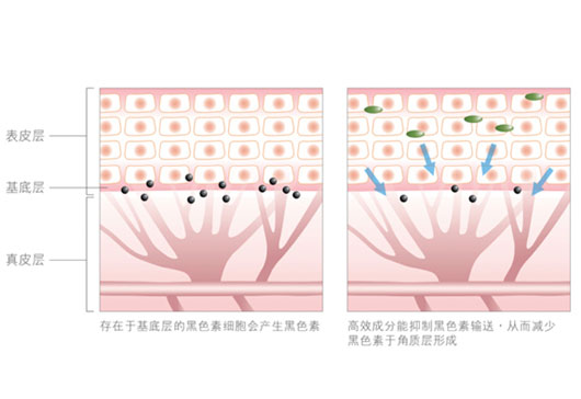 洛纳丹蒂为你揭秘2016年最赚钱的祛斑技术（图）_1