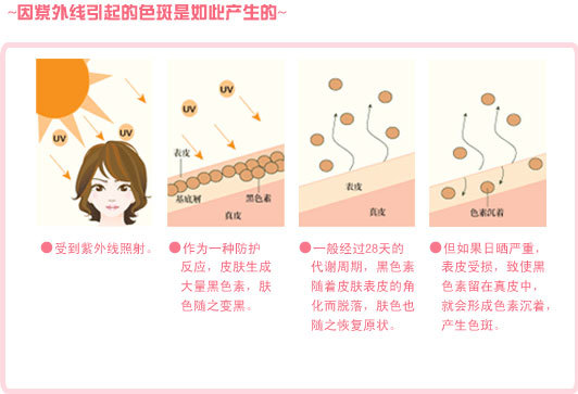 洛纳丹蒂为你揭秘2016年最赚钱的祛斑技术（图）_2