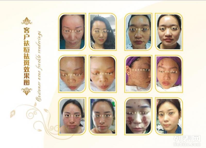 芳緣多祛斑加盟 全國連鎖美容院加盟 2萬投資門檻優(yōu)惠進(jìn)行中_1