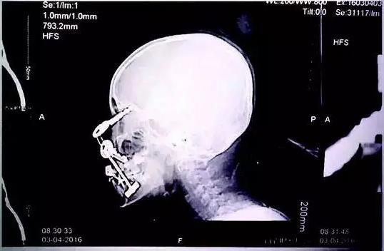 【南通睿祺智能科技-睿祺無鎖孔智能門】對不起，你的時代已經(jīng)過去?。▓D）_2