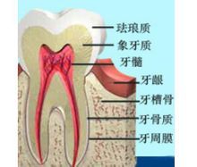 口腔執(zhí)業(yè)醫(yī)告訴您師牙骨質(zhì)齲的病理變化（圖）_1