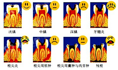 郑州口腔执业医师之常见牙髓变性的病理变化（图）_3