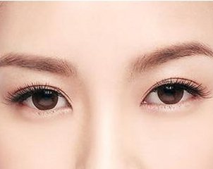 商丘做雙眼皮哪里比較好呢?（圖）_1