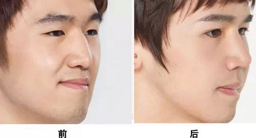 商丘華美鼻綜合整形（圖）_2