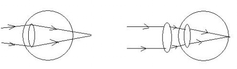 近視、遠視、老花，傻傻分不清_3