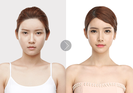 商丘最好的整形美容醫(yī)院醫(yī)院（圖）_1