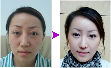 商丘黑臉娃娃祛斑效果好不好？（圖）_1