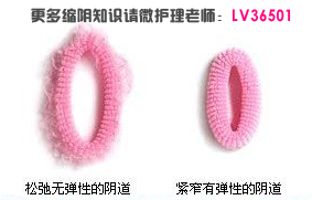 產(chǎn)后陰道松弛怎么辦？縮陰產(chǎn)品有用嗎（圖）_2