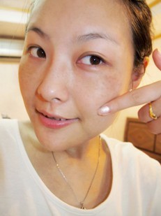 色斑的形成原因及分類 助你打造水嫩肌膚（圖）_1