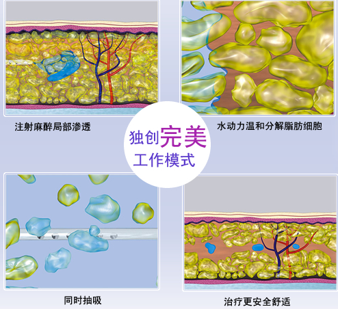 商丘面部吸脂瘦脸专业的医院？（图）_3