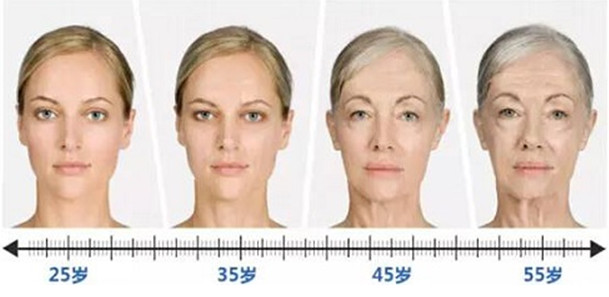 關于面部皺紋衰老問題你必須知道的事?。▓D）_1
