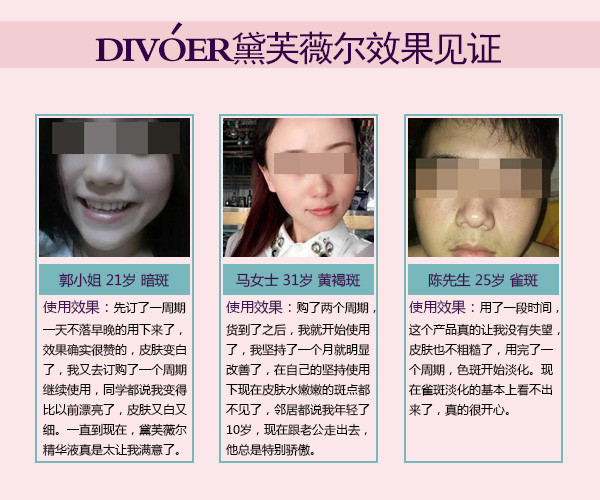 生完孩子后長黃褐斑該怎么辦呢 坐月子期間怎樣祛斑（圖）_5