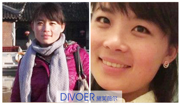 怎么除產(chǎn)后黃褐斑 喝什么中藥可以祛斑（圖）_2