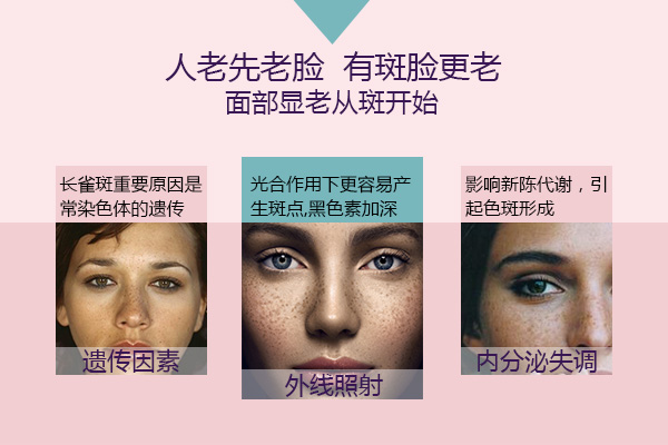 產(chǎn)后怎么快速祛黃褐斑 臉上長黑斑是什么原因（圖）_1