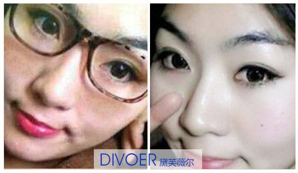 產(chǎn)后臉上有黃褐斑咋辦 祛斑最有效果的方法有哪些（圖）_2