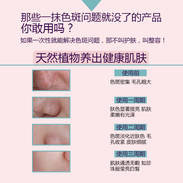 產(chǎn)后臉上有黃褐斑咋辦 祛斑最有效果的方法有哪些（圖）_3