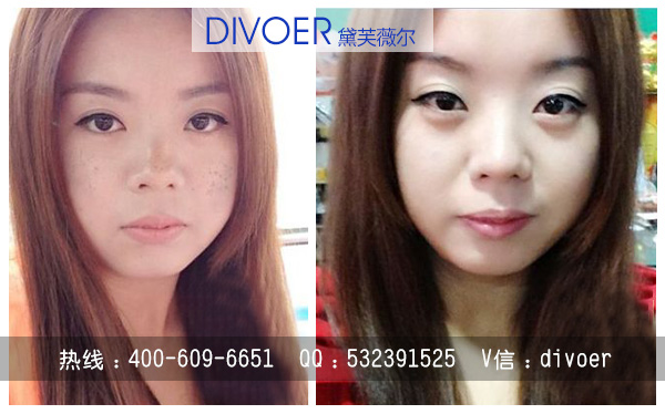 產(chǎn)后黃褐斑怎樣才能去掉 化妝品祛斑效果排名（圖）_2