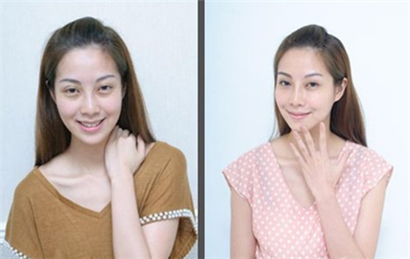 怎樣有效去除眼袋（圖）_1