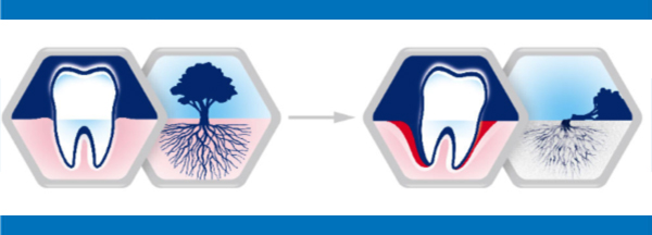 引起牙齦出血的原因有哪些？漱小白牙齦統(tǒng)計據(jù)說有80%的人不懂牙齦護理（圖）_3