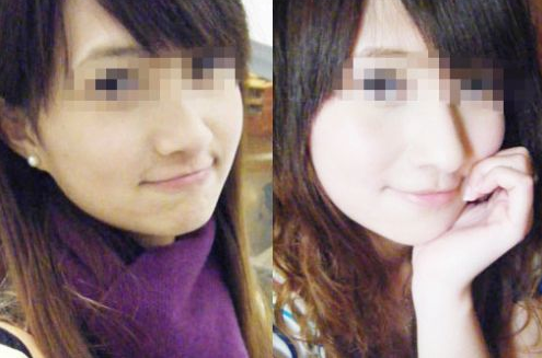 商丘美白針價格表（圖）_1