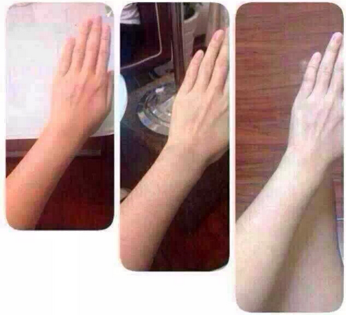 商丘打美白針比較正規(guī)的醫(yī)院？（圖）_2