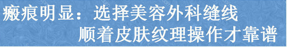 商丘做完雙眼皮留下疤痕咋辦呢？（圖）_1