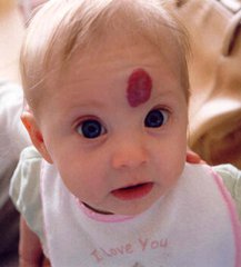 深圳祛痣哪里比較好，激光祛痣多少錢（圖）_1