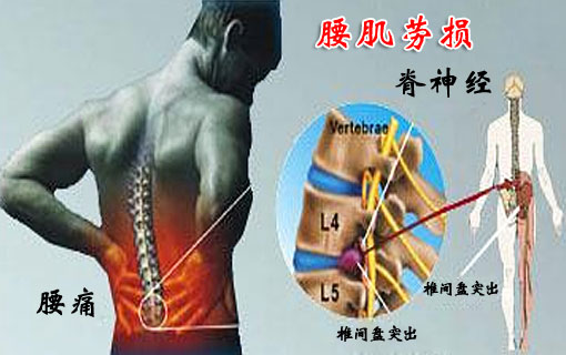 王九正祖传黑膏药真的有效吗？（图）_2