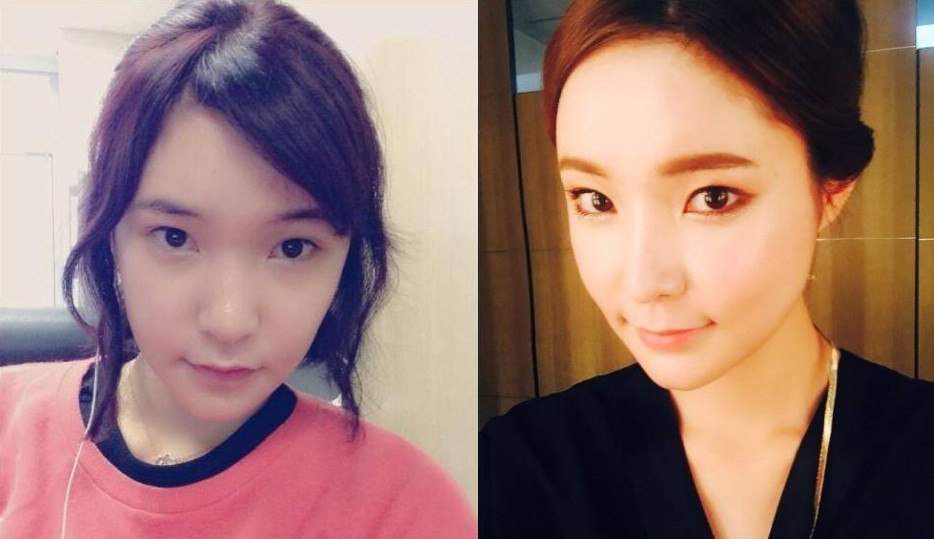 商丘天生塌鼻子、大鼻頭怎么辦？（圖）_1