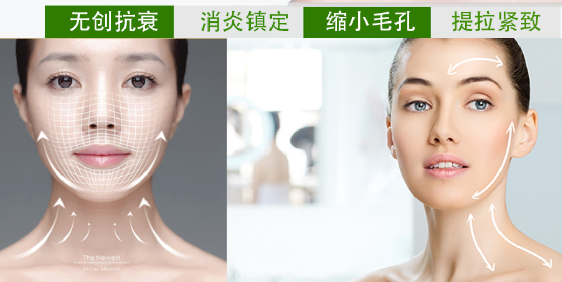 射頻儀器哪個(gè)牌子好（圖）_1