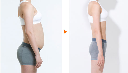 商丘背部吸脂手術(shù)多少錢？（圖）_1