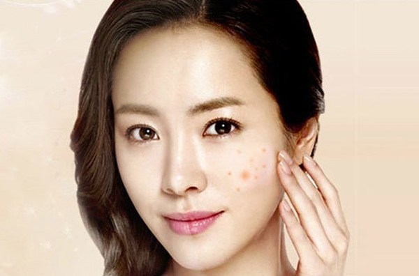 祛斑儀器哪種好（圖）_1