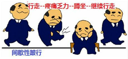 擺脫疼痛,改善腰椎間盤突出正確的方法_2