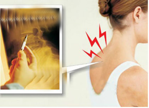 這樣改善疼痛有奇效，頸椎病改善的有效方法_2