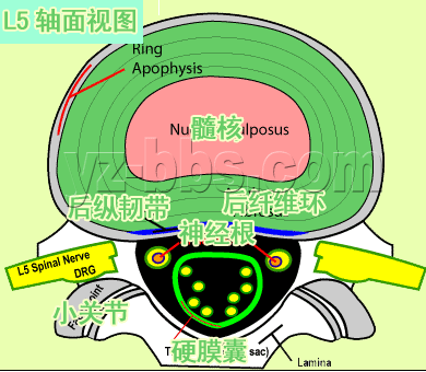 腰间盘突出改善有要领,好的改善方法值得学习_1