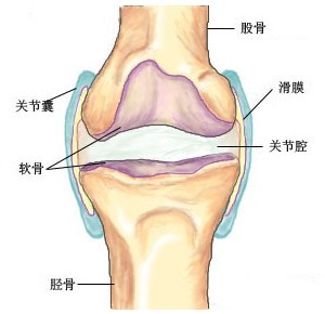 滑膜炎引起关节肿胀怎么有效的护理和改善呢？_1