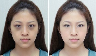 專家支招 讓你輕松告別黑眼圈 眼袋（圖）_1